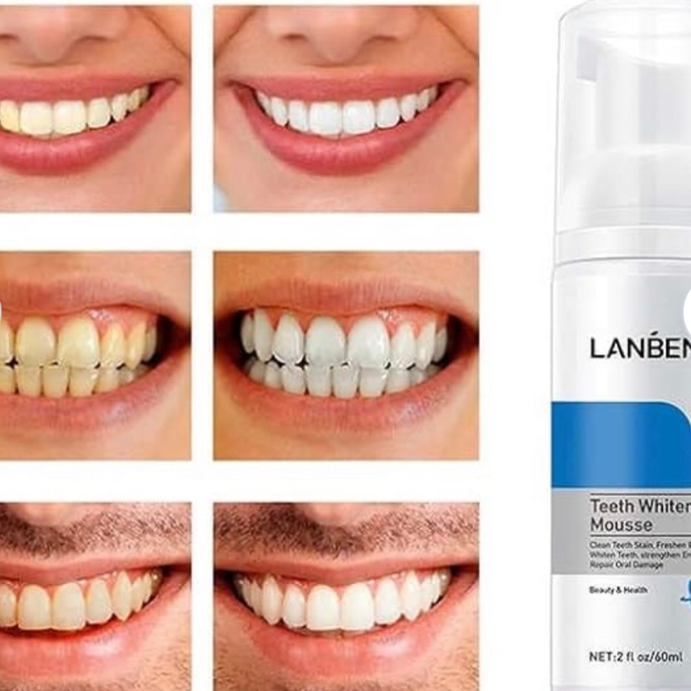 Lanbena Teeth Whitening  Mousse, Clean and Whiten Teeth, Strengthen Enamel 🆕 - Picture 7 of 8